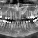 Gölcük Ortodonti